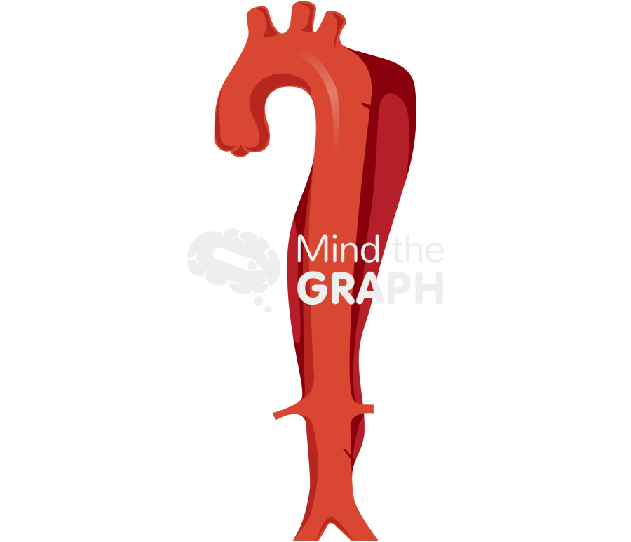 Aortic dissection classification 3b Icons, Symbols, Pictures, and Images