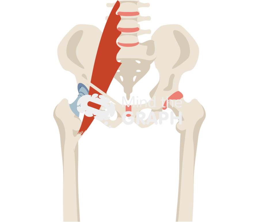 Iliopsoas impingement and total hip arthroplasty bone full Icons, Symbols, Pictures, and Images