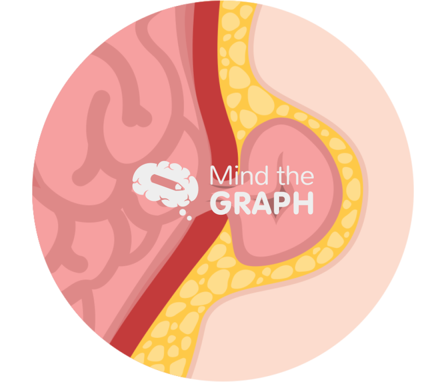 Abdominal ventral hernia Icons, Symbols, Pictures, and Images