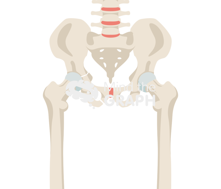Acetabular fracture 2 bone full Icons, Symbols, Pictures, and Images