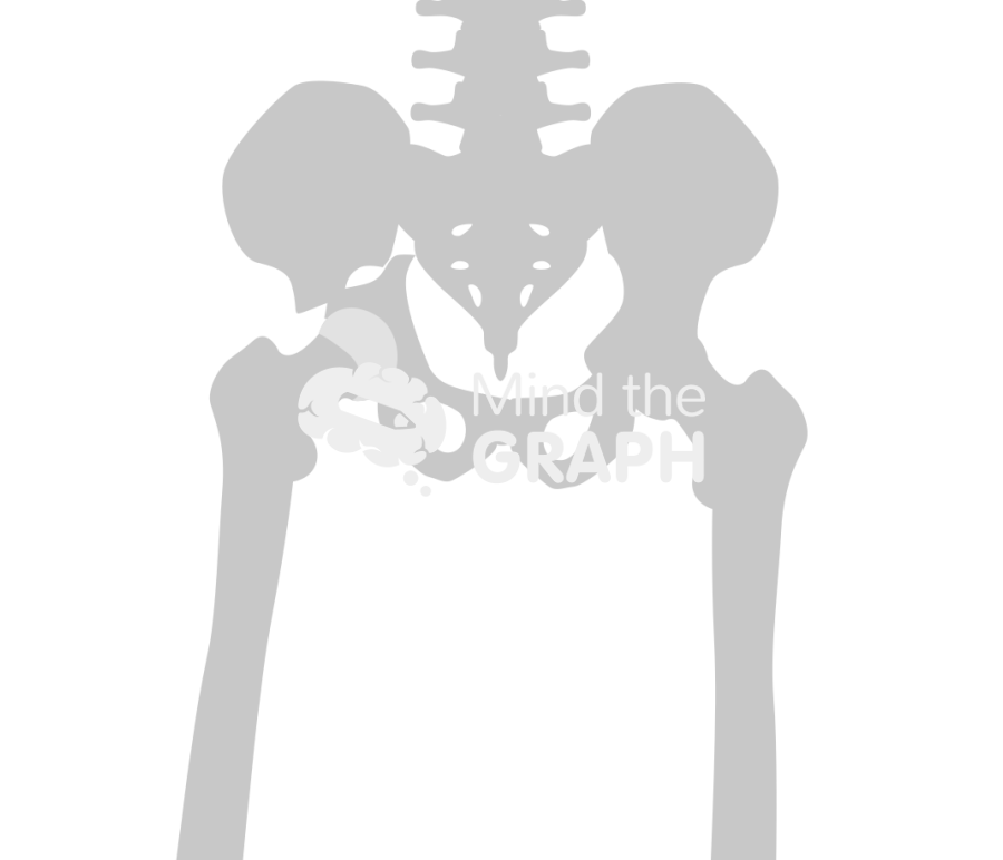 Acetabular fracture bone Icons, Symbols, Pictures, and Images