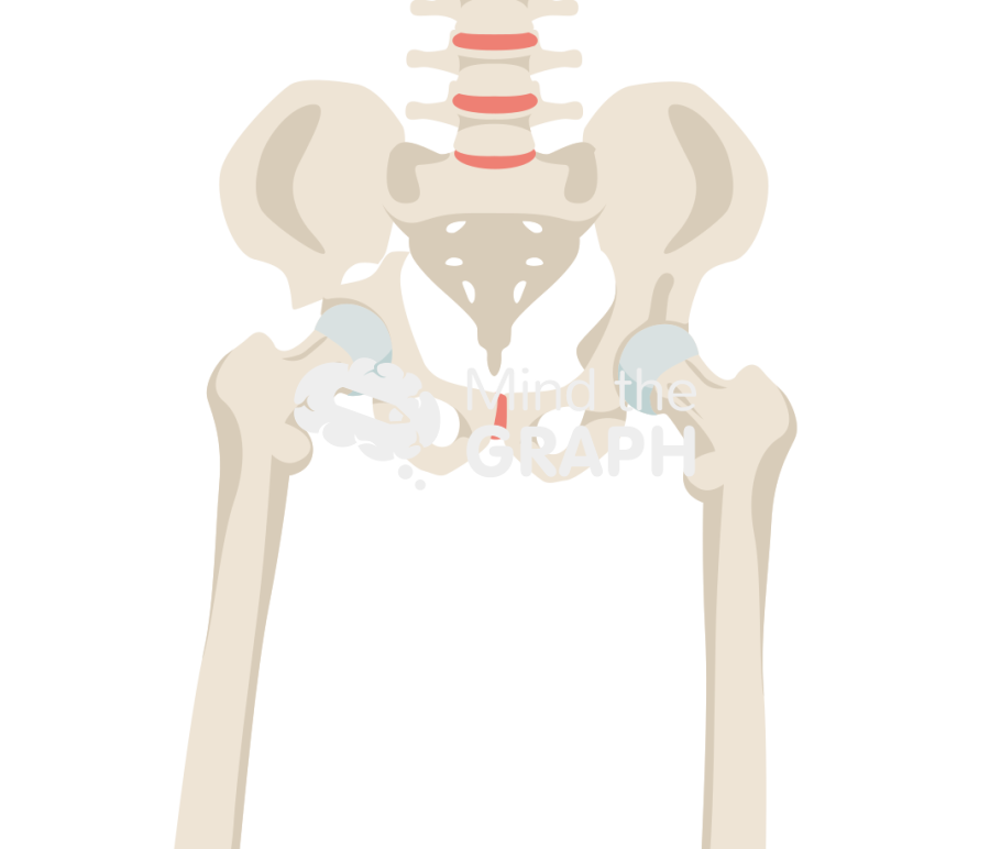 Acetabular fracture bone full Icons, Symbols, Pictures, and Images