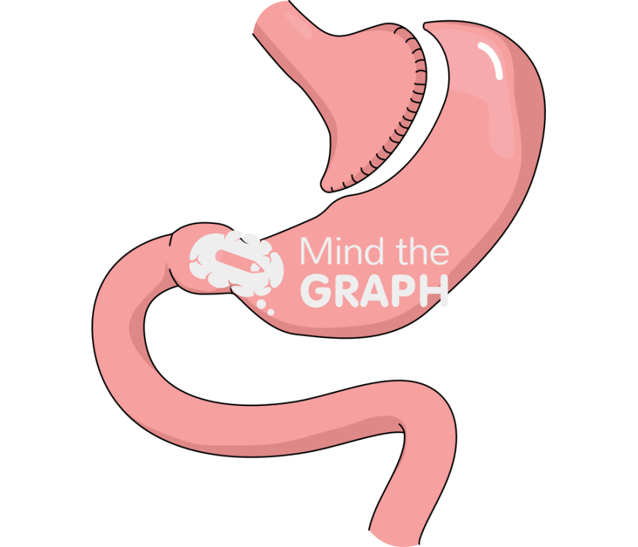 Achalasia gastric tube Icons, Symbols, Pictures, and Images