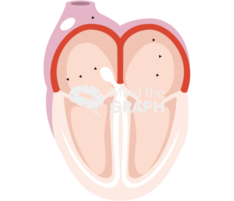 Activation atria heart Icons, Symbols, Pictures, and Images