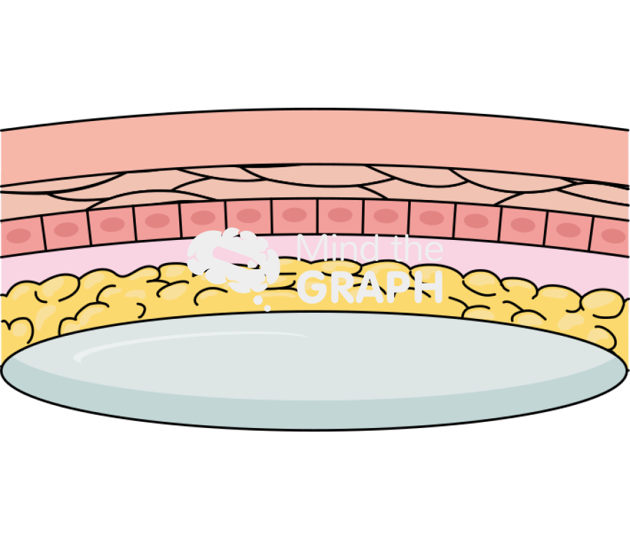 Active tissue expander under skin Icons, Symbols, Pictures, and Images