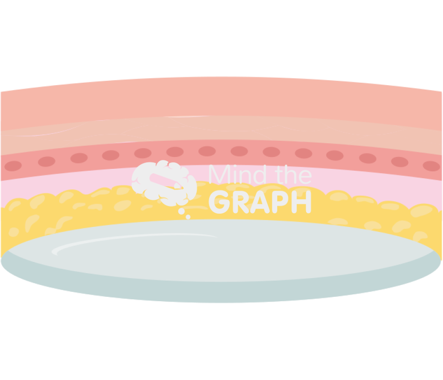 Active tissue expander under skin Icons, Symbols, Pictures, and Images