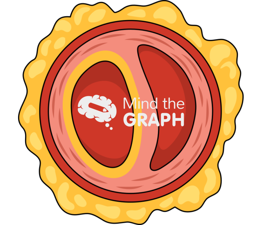 Free Acute aortic dissection Icons, Symbols, Pictures, and Images