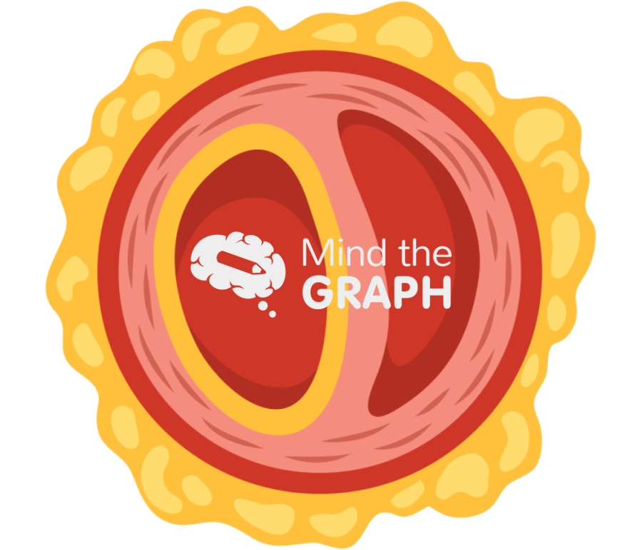 Acute aortic dissection Icons, Symbols, Pictures, and Images
