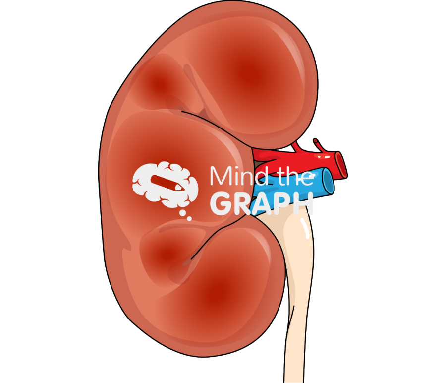 Acute kidney injury Icons, Symbols, Pictures, and Images