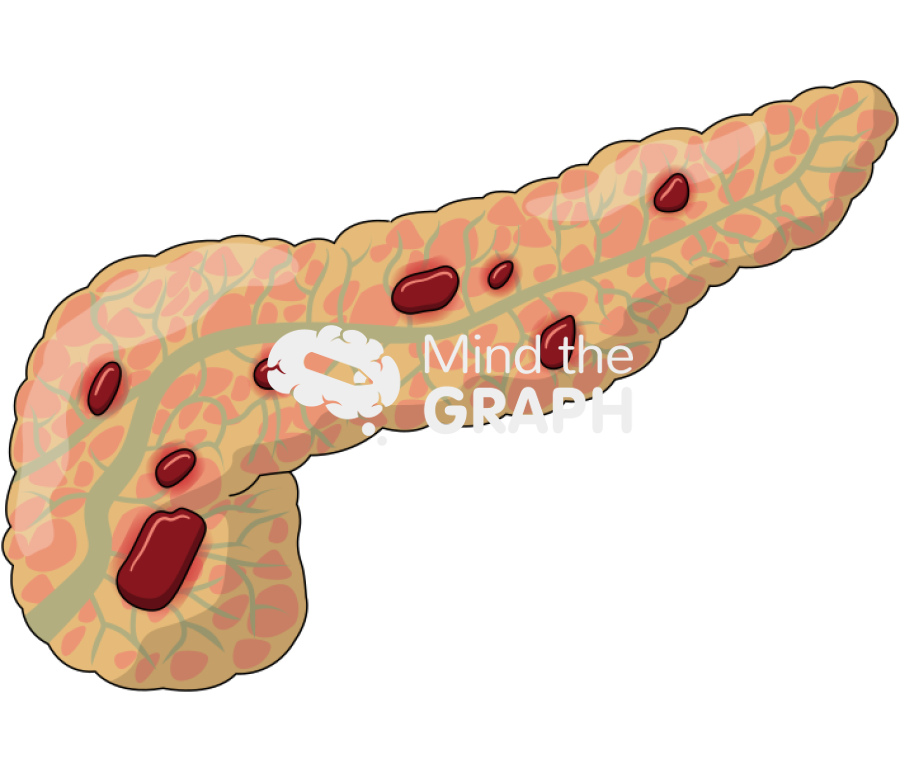 Acute pancreatitis Icons, Symbols, Pictures, and Images
