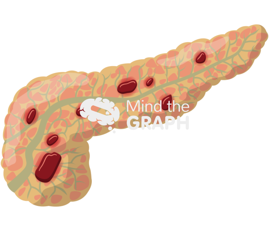 Acute pancreatitis Icons, Symbols, Pictures, and Images