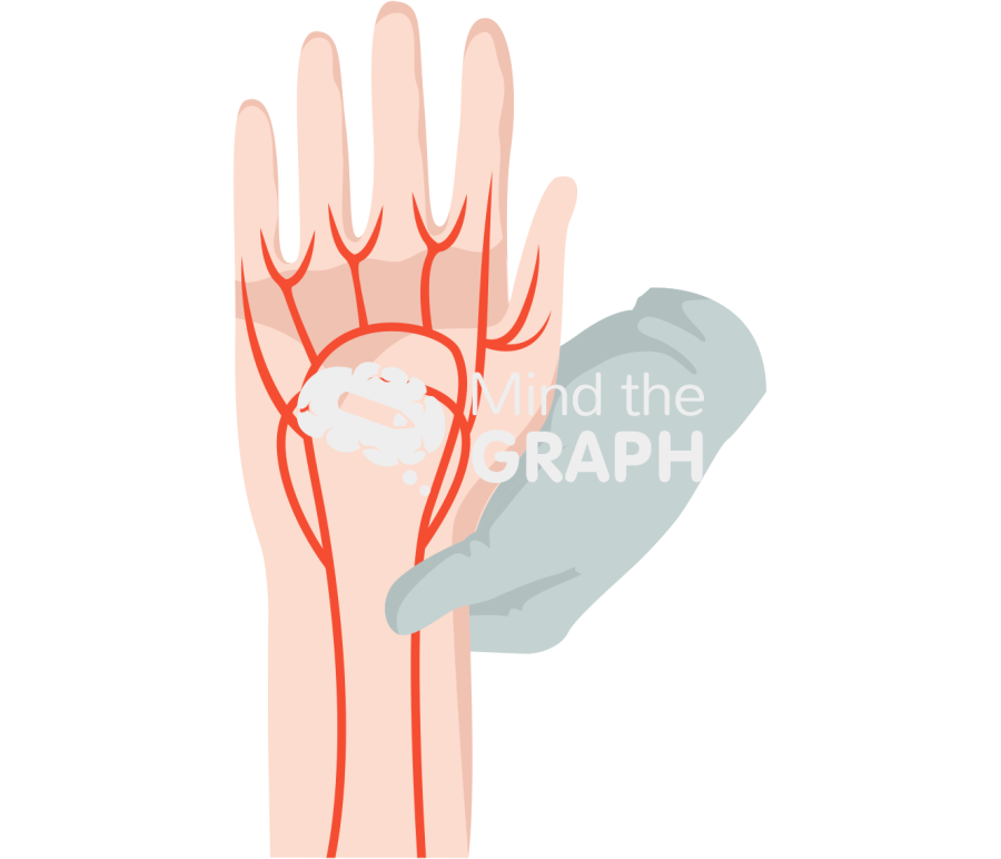 Allen test arterial blood 2 Icons, Symbols, Pictures, and Images