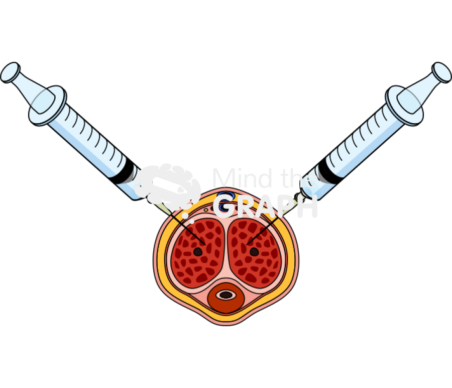 Alprostadil injection 10 oclock 2 oclock positions penis transversal cut Icons, Symbols, Pictures, and Images