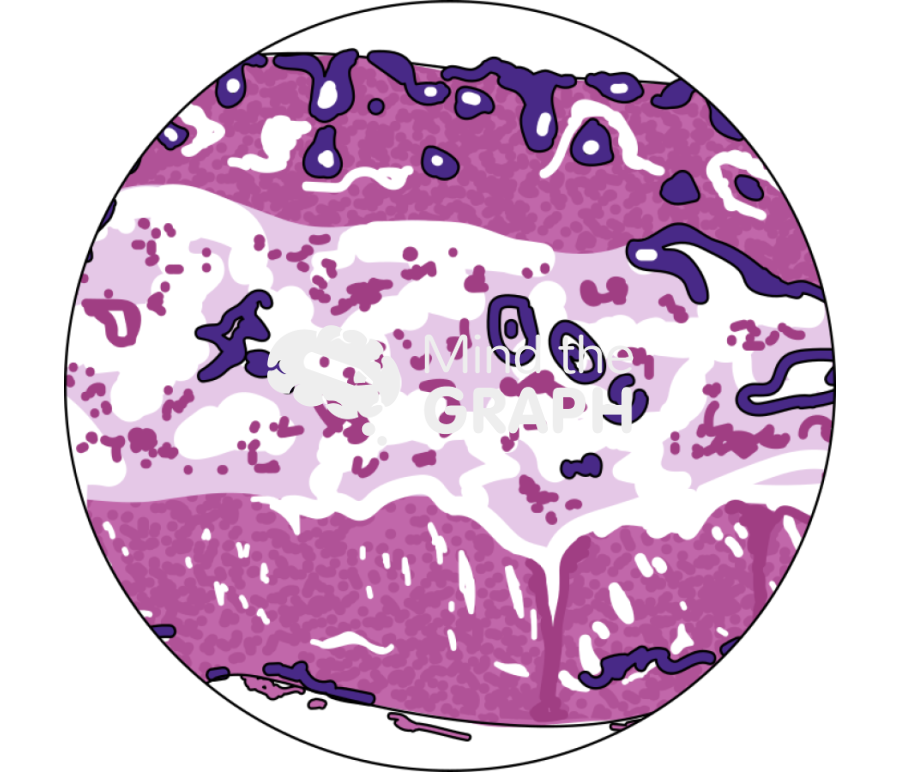Altered submucosa histology zoom Icons, Symbols, Pictures, and Images
