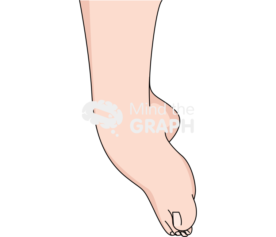 Ankle inversion fair Icons, Symbols, Pictures, and Images