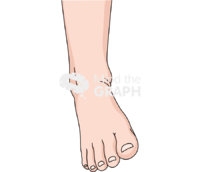 Ankle sprain front Icons, Symbols, Pictures, and Images
