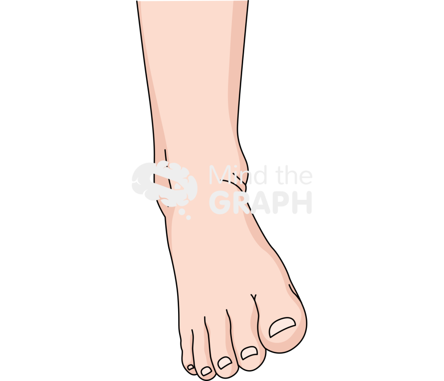 Ankle sprain front Icons, Symbols, Pictures, and Images