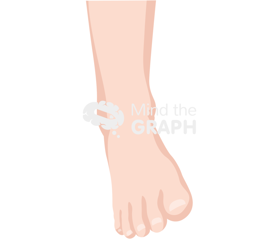 Ankle sprain front Icons, Symbols, Pictures, and Images