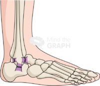 Ankle sprain lateral body full Icons, Symbols, Pictures, and Images