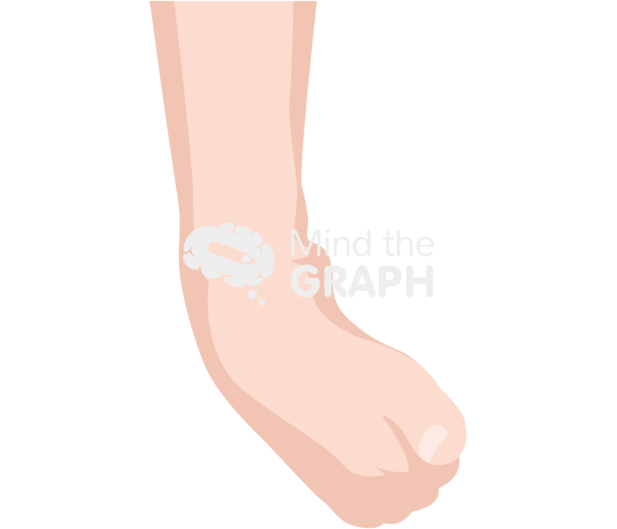 Ankle sprain severe front Icons, Symbols, Pictures, and Images