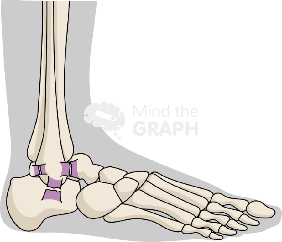 Ankle sprain severe lateral body Icons, Symbols, Pictures, and Images