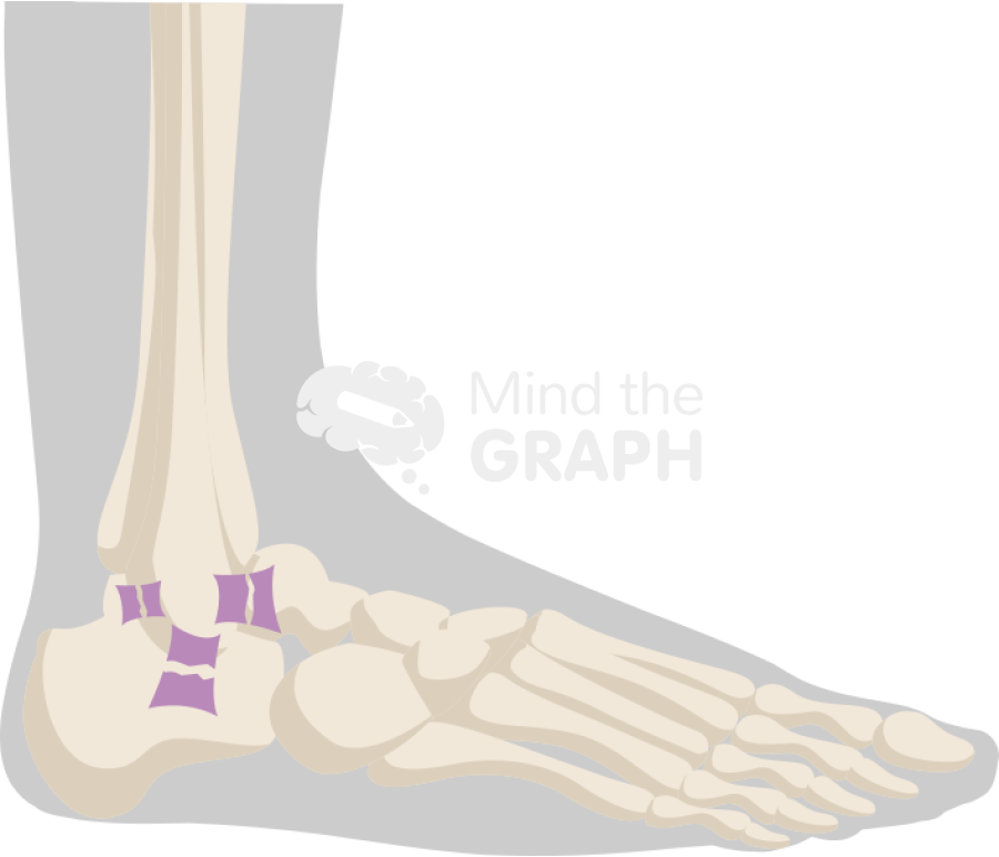 Ankle sprain severe lateral body Icons, Symbols, Pictures, and Images