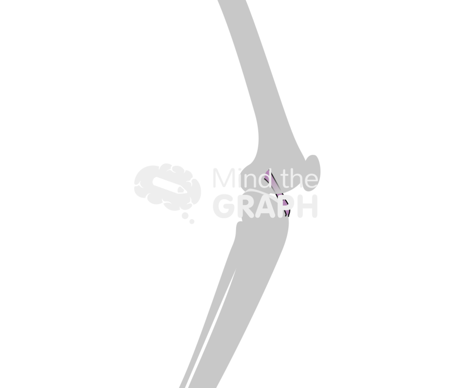 Anterior cruciate ligament wear knee bone Icons, Symbols, Pictures, and Images