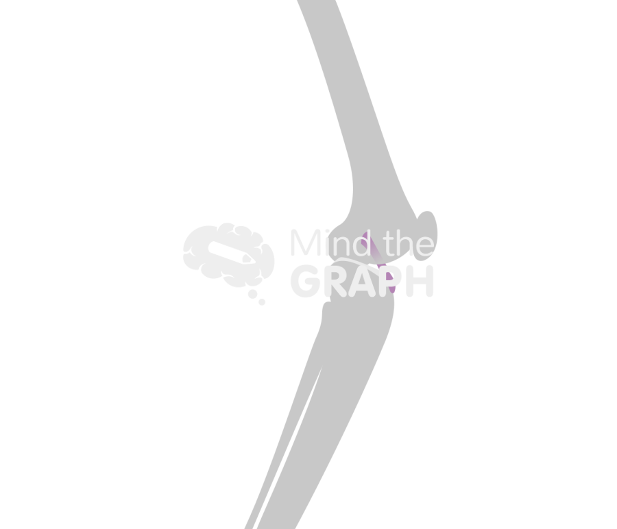 Anterior cruciate ligament wear knee bone Icons, Symbols, Pictures, and Images