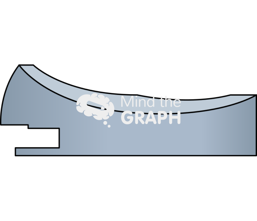 Anterior stabilized spacer Icons, Symbols, Pictures, and Images
