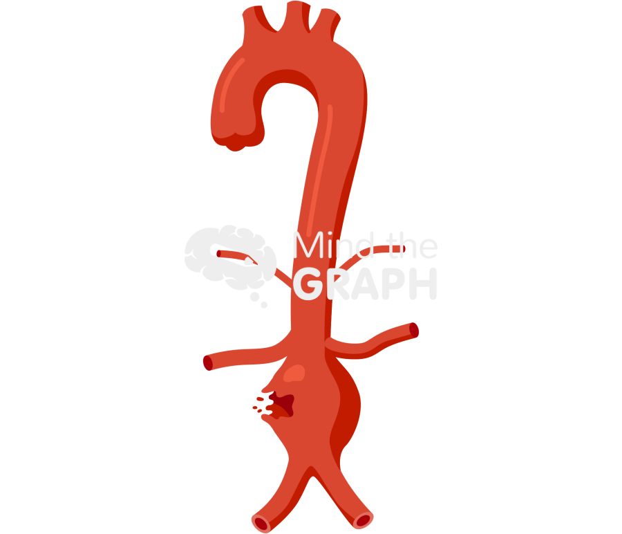 Aortic aneurysm rupture front Icons, Symbols, Pictures, and Images