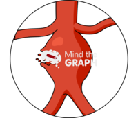 Aortic aneurysm rupture front zoom - Edit and Customize Icons of Aortic aneurysm rupture front zoom Aortic aneurysm rupture front zoom Icons, Symbols, Pictures, and Images