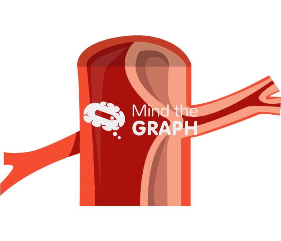 Aortic dissection dynamic Icons, Symbols, Pictures, and Images