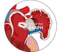 Appendage peri device leak closure zoom Icons, Symbols, Pictures, and Images