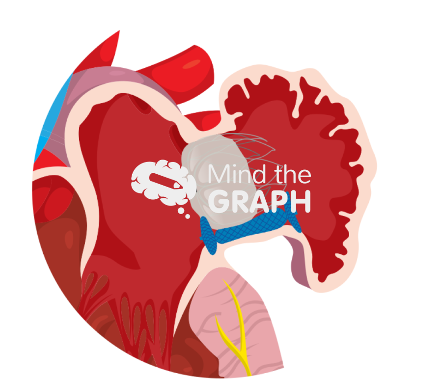 Appendage peri device leak closure zoom Icons, Symbols, Pictures, and Images