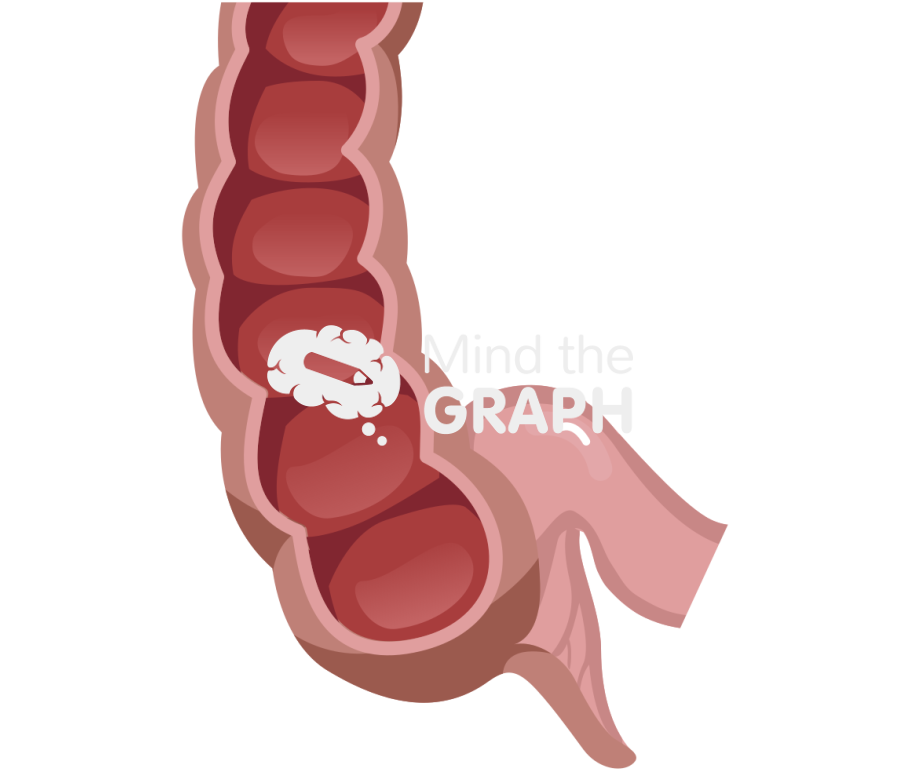 Appendix ileum Icons, Symbols, Pictures, and Images