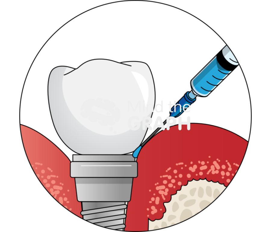 Application fluid periimplantitis zoom Icons, Symbols, Pictures, and Images