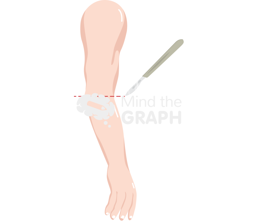 Arm amputation lateral Icons, Symbols, Pictures, and Images