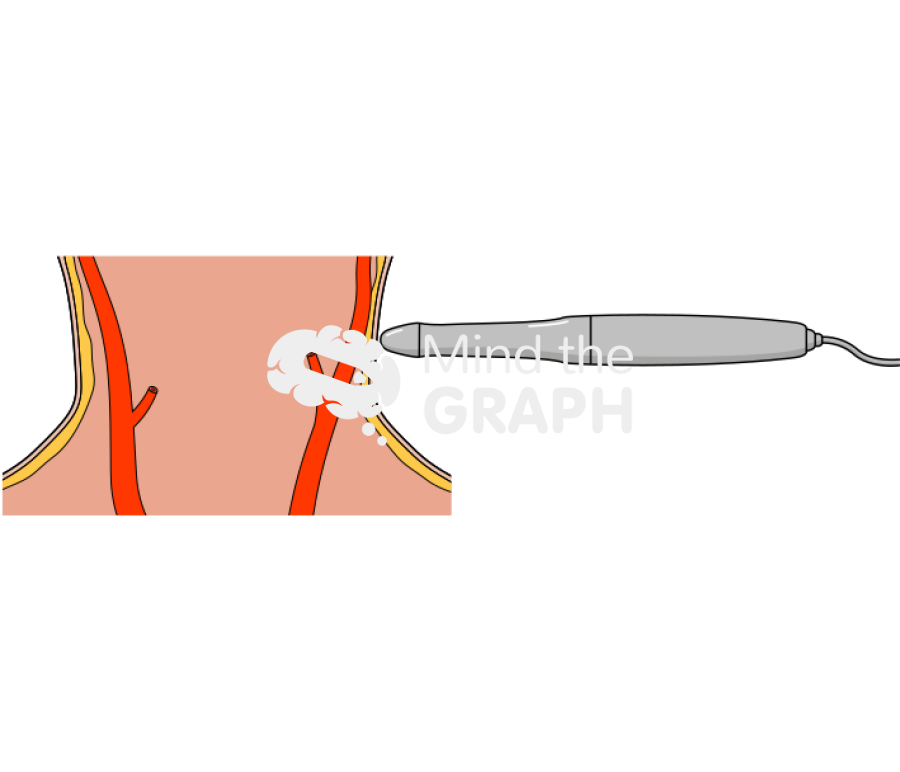 Arterial pulse neck pen Icons, Symbols, Pictures, and Images