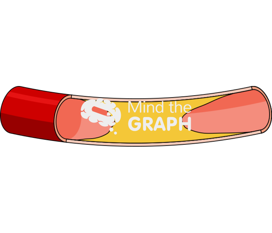 Artery an occluded longitudinal cut Icons, Symbols, Pictures, and Images