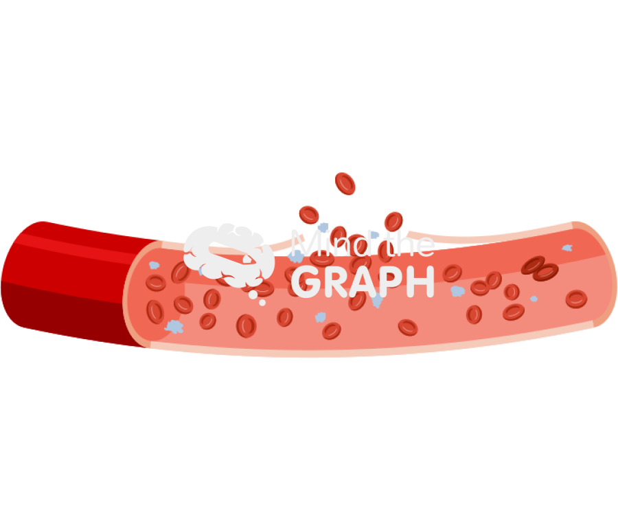 Artery blood clot 1 longitudinal cut Icons, Symbols, Pictures, and Images