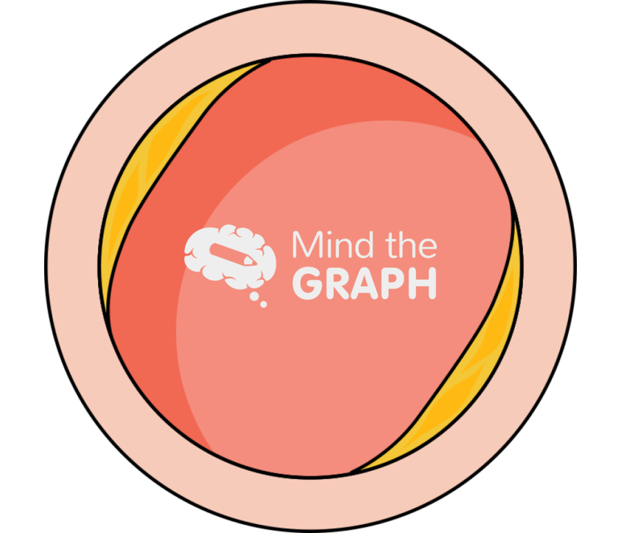 Artery compressed plaque transversal cut Icons, Symbols, Pictures, and Images