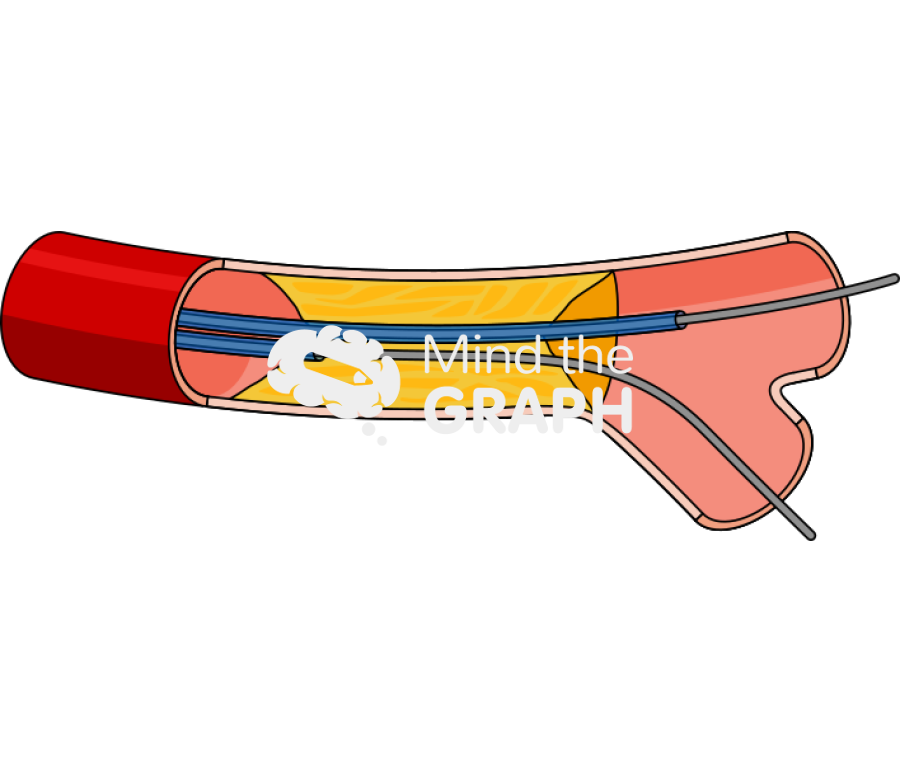 Artery dual lumen microcatheter longitudinal cut Icons, Symbols, Pictures, and Images