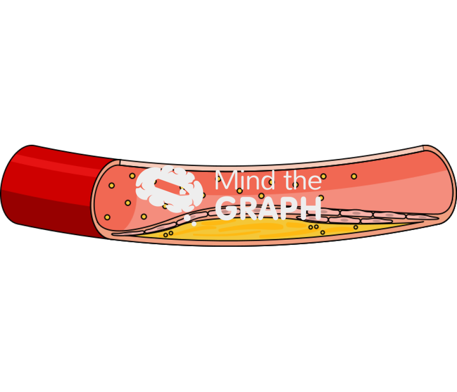 Artery lipid peroxidation longitudinal cut Icons, Symbols, Pictures, and Images