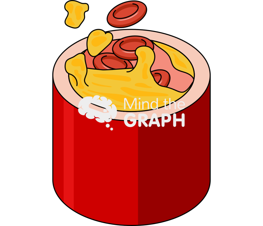 Artery plaque emboli breaking off Icons, Symbols, Pictures, and Images