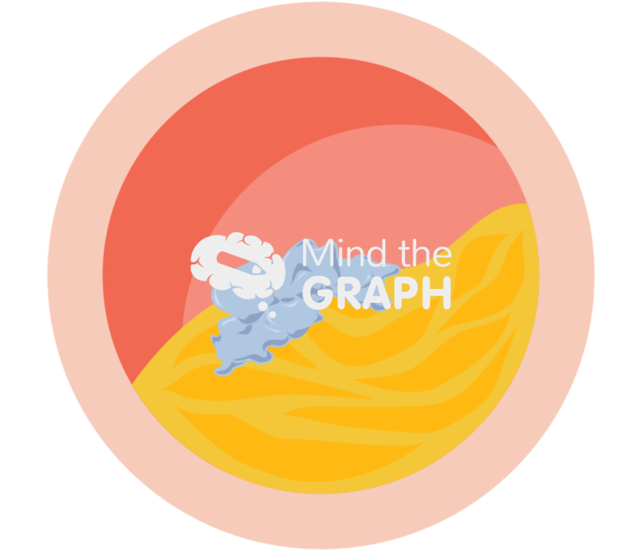 Artery unstable plaque angina transversal cut Icons, Symbols, Pictures, and Images