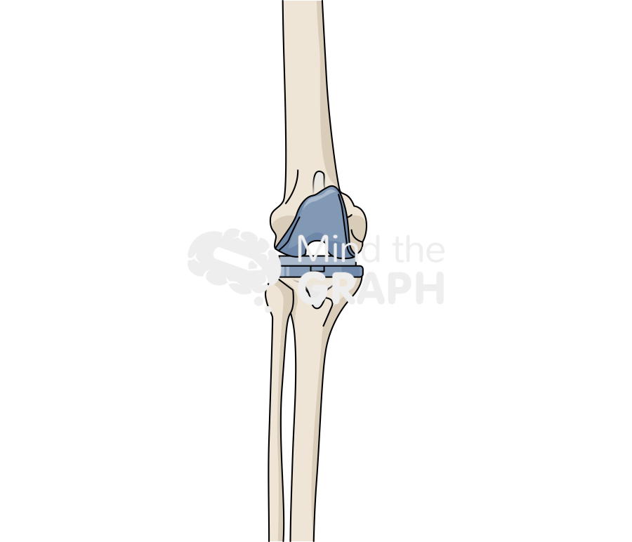 Articulating spacer anteroposterior knee bone full Icons, Symbols, Pictures, and Images