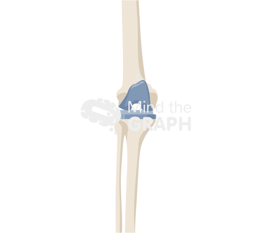 Articulating spacer anteroposterior knee bone full Icons, Symbols, Pictures, and Images