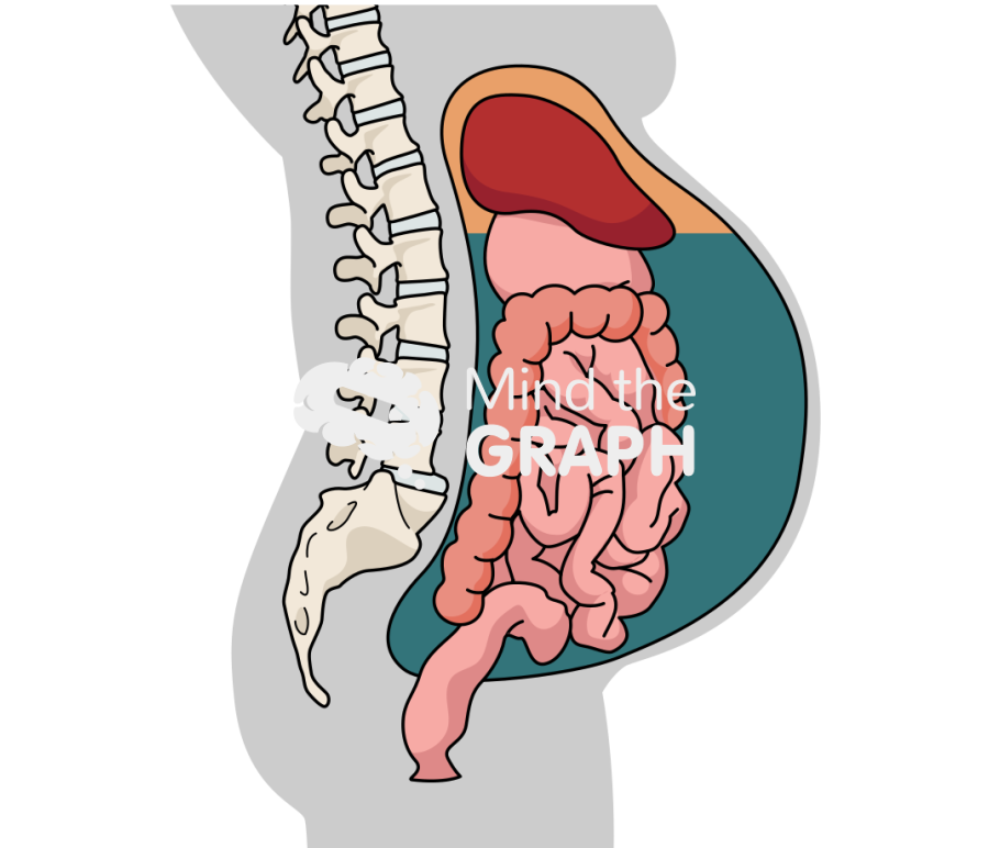 Ascitic fluid peritoneal cavity lateral cut Icons, Symbols, Pictures, and Images