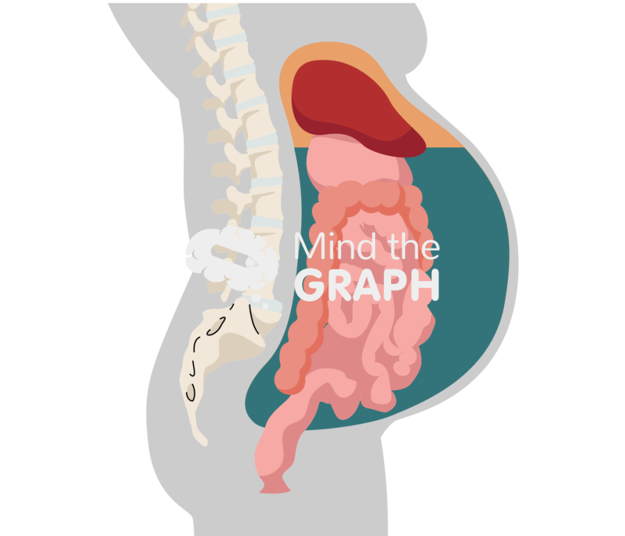 Ascitic fluid peritoneal cavity lateral cut Icons, Symbols, Pictures, and Images