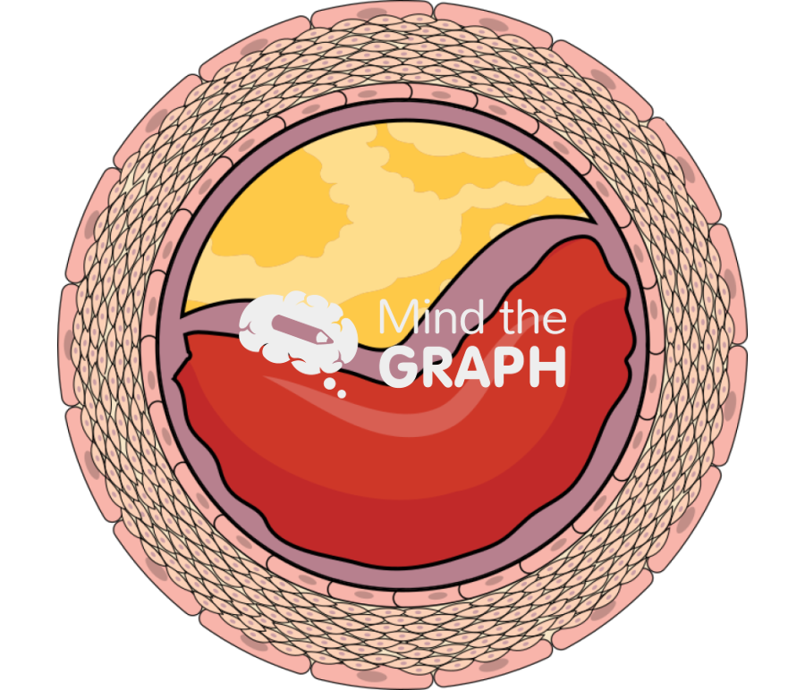 Atheroma 3 Icons, Symbols, Pictures, and Images